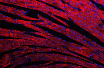 Desmin Antibody