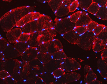 Desmin Antibody