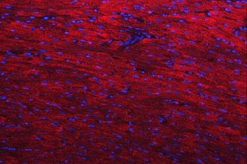 Desmin Antibody