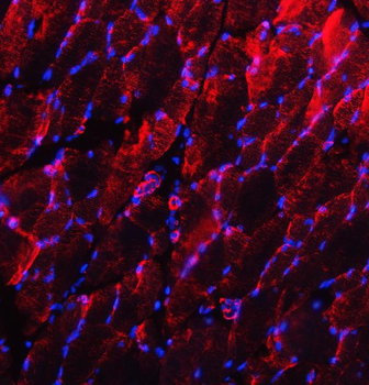 Desmin Antibody