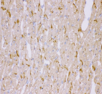 Desmin Antibody