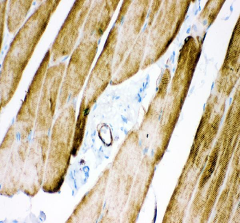 Desmin Antibody