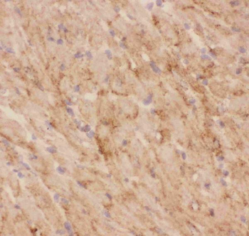 Glucose Transporter GLUT4/SLC2A4 Antibody