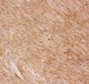 Glucose Transporter GLUT4/SLC2A4 Antibody