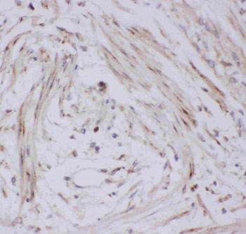 Glucose Transporter GLUT4/SLC2A4 Antibody