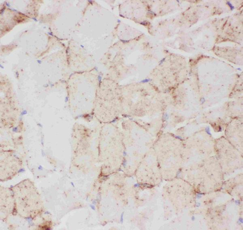 Glucose Transporter GLUT4/SLC2A4 Antibody