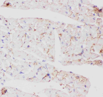 Glucose Transporter GLUT4/SLC2A4 Antibody