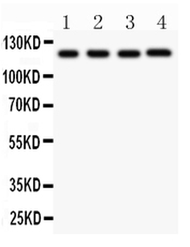 CIAS1/NALP3/NLRP3 Rabbit Polyclonal Antibody