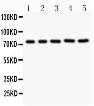 RIP/RIPK1 Rabbit Polyclonal Antibody