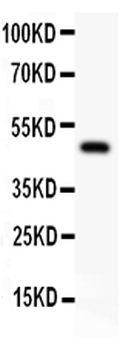 AP2 alpha/TFAP2A Rabbit Polyclonal Antibody