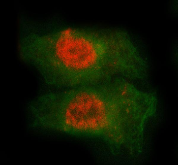 MED7 Rabbit Polyclonal Antibody