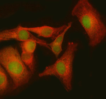 MBNL3 Rabbit Polyclonal Antibody