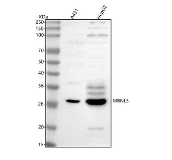 MBNL3 Rabbit Polyclonal Antibody