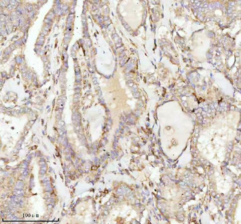 NDUFA9 Antibody