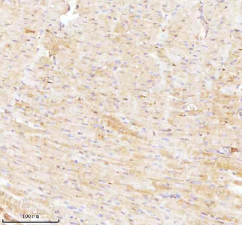 NDUFA9 Antibody