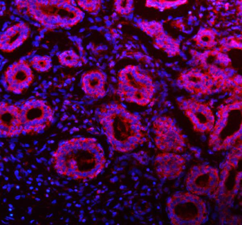 NDUFA9 Antibody