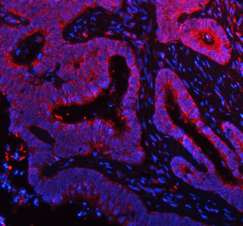 NDUFA9 Antibody