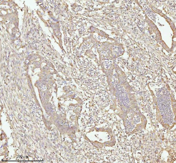 NDUFA9 Antibody