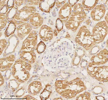 NUDT19 Rabbit Polyclonal Antibody