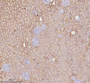 NUDT19 Rabbit Polyclonal Antibody