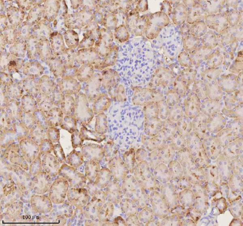 NUDT19 Rabbit Polyclonal Antibody