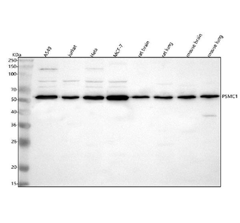 PSMC1 Rabbit Polyclonal Antibody