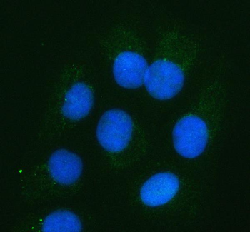 NDUFB4 Rabbit Polyclonal Antibody
