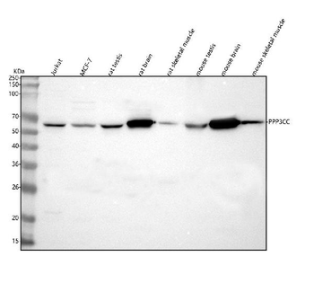 PPP3CC Rabbit Polyclonal Antibody