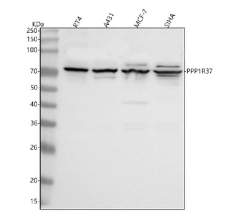 PPP1R37 Rabbit Polyclonal Antibody
