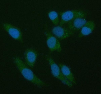 PPEF1 Rabbit Polyclonal Antibody