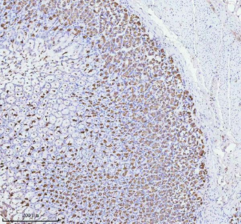 ATP4B Antibody