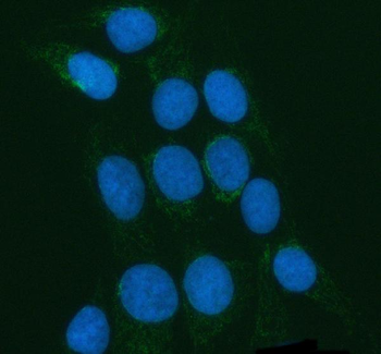 POLDIP2 Rabbit Polyclonal Antibody