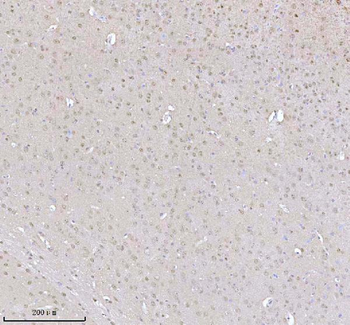 MECP2 Rabbit Polyclonal Antibody