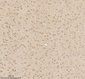 MECP2 Rabbit Polyclonal Antibody