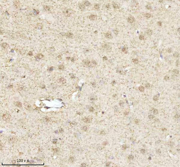 MECP2 Rabbit Polyclonal Antibody