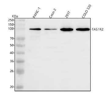 TAS1R2 Rabbit Polyclonal Antibody