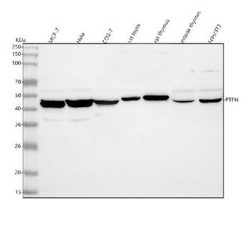 PTEN Rabbit Polyclonal Antibody