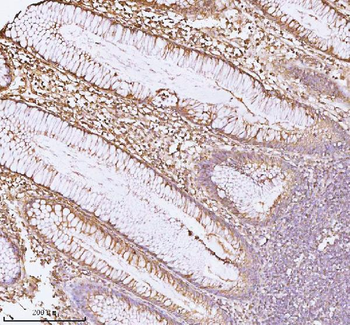 CD44 Rabbit Polyclonal Antibody