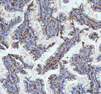 CD44 Rabbit Polyclonal Antibody
