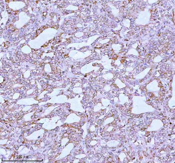 ME3 Antibody
