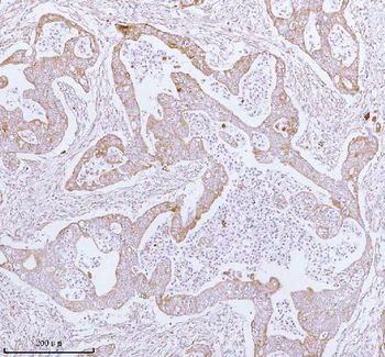ME3 Antibody