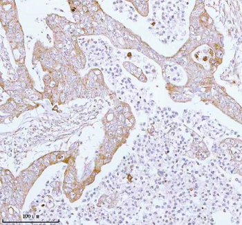 ME3 Antibody