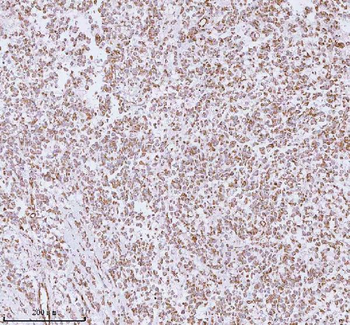 ME3 Antibody