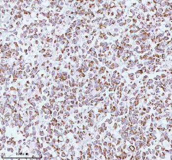 ME3 Antibody