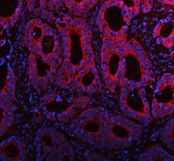 ME3 Antibody