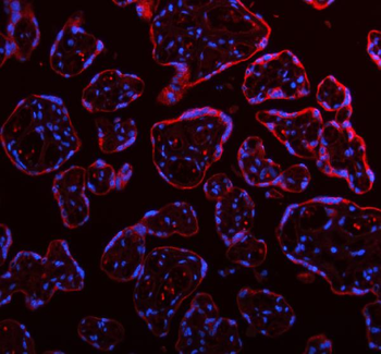 ME3 Antibody