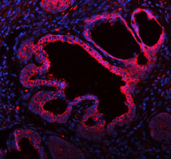 ME3 Antibody