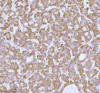 ME3 Antibody