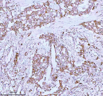 ME3 Antibody