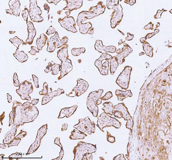 ME3 Antibody